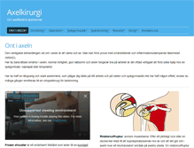 Tablet Screenshot of impingement.se